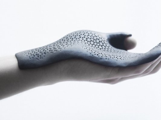 3D打印用于大规模肢体矫形器个性定制