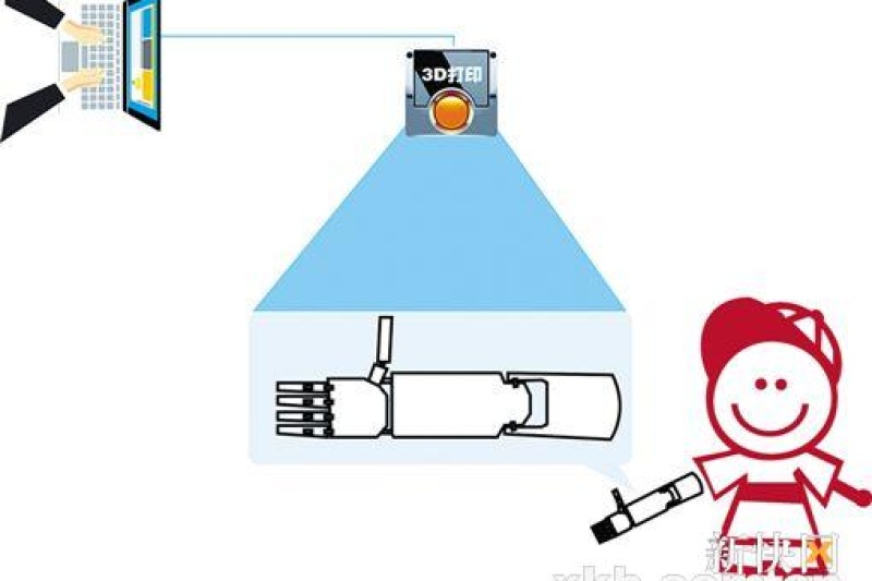 3D打印假肢 科技到现实的距离