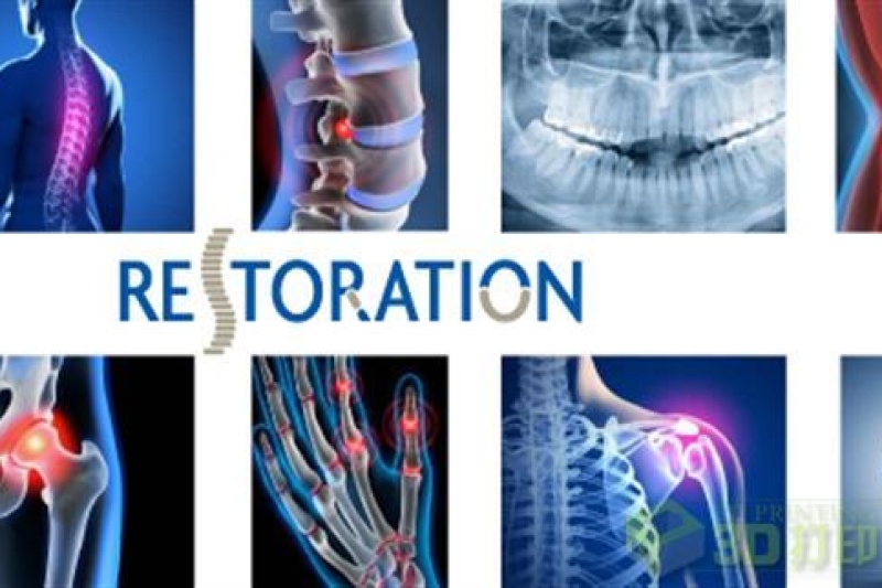 PK金属植入物 3D打印生物陶瓷植入物不再遥远