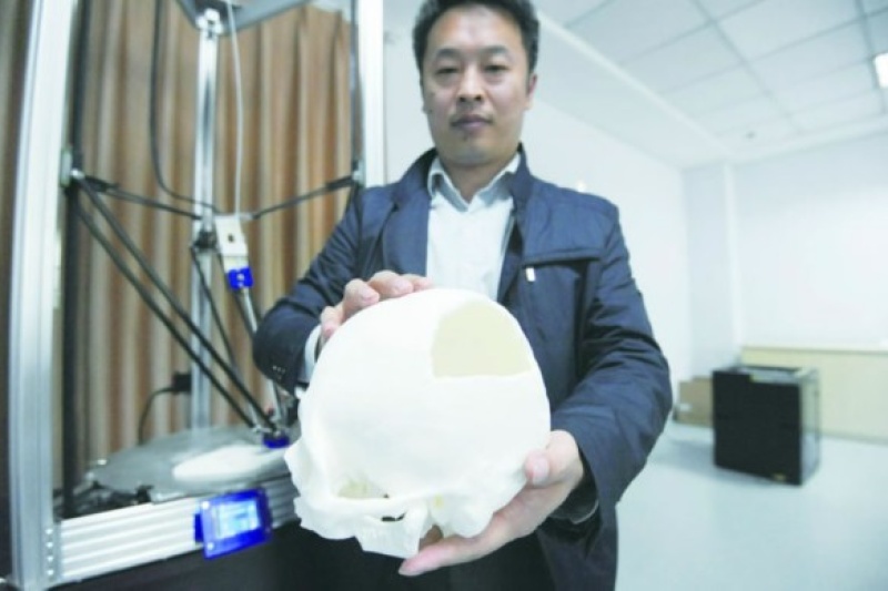 青岛首个医学3D打印中心成立并应用于临床