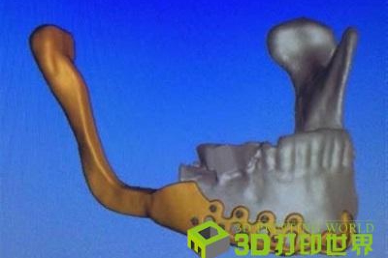 韩国：将修改法规快速审批3D打印医疗仪器