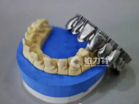 铂力特：金属3D打印如何变革义齿生产行业？