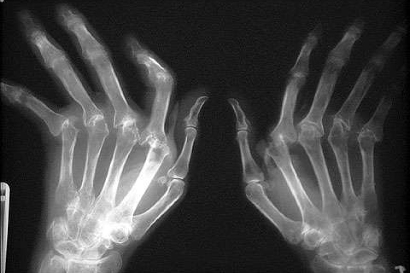 Organovo与加州大学联合开发3D生物打印骨组织技术