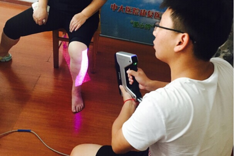 太酷了：南京中大医院首次使用EinScan-Pro为病人定制个性化支具