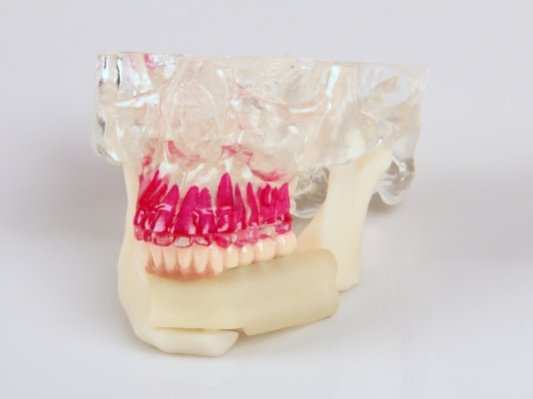 3D Systems发布颌骨、牙科虚拟手术规划产品Jaw in a Day