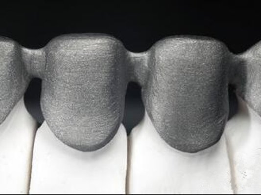 3D打印：口腔数字化变革的必然选择