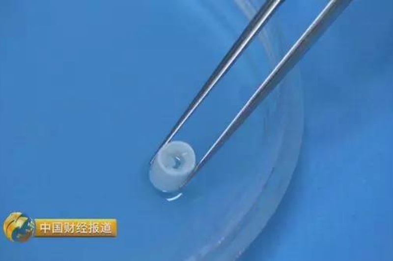 央视披露大量细节："四川造"3D打印血管在猴体内实验成功