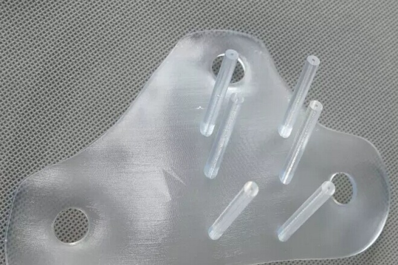 光韵达数字医疗3D打印技术应用肛肠领域 实现沪上首例便秘患者骶神经调节植入