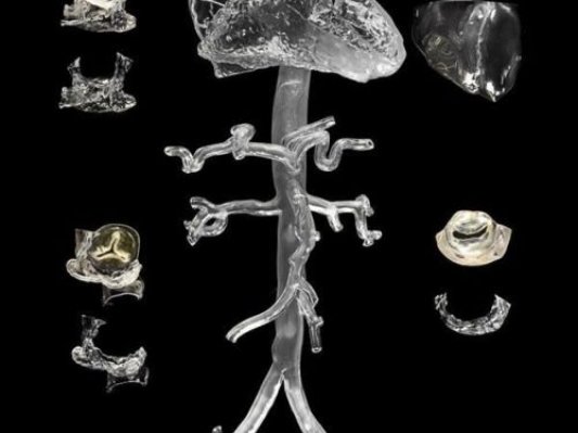 打开导管心脏手术的大门——欣赏一组透明高精度3D打印心脏模型