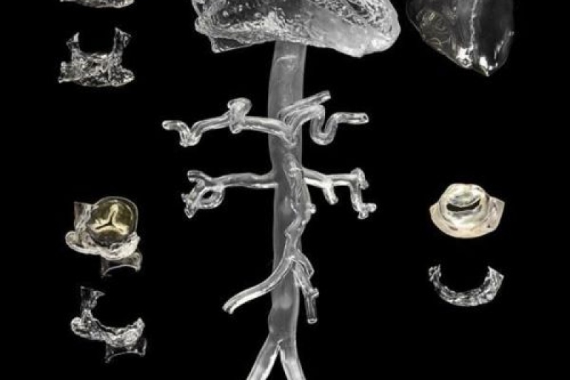 打开导管心脏手术的大门——欣赏一组透明高精度3D打印心脏模型