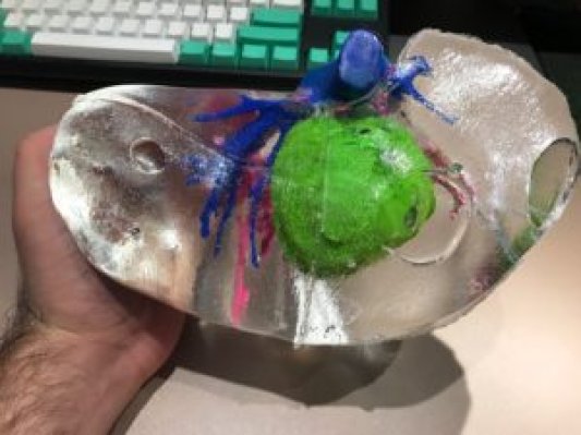 不到1000元人民币，创建低成本彩色肝脏3D打印模型