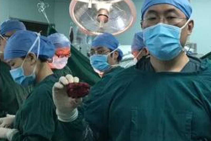 南方医科大学第三附属医院开展广东省首例3D打印人工椎体植入手术