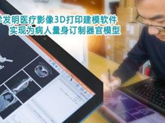 牛！大连理工发明医疗影像3D打印建模软件填补国内空白