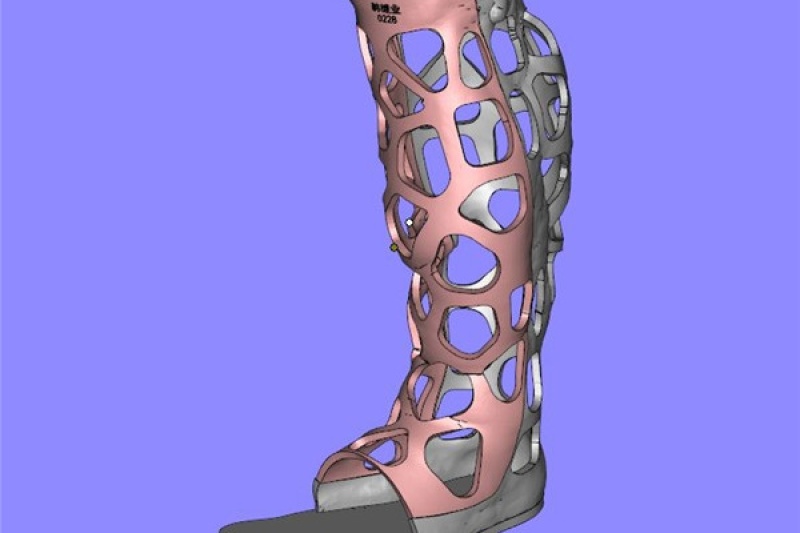 塑成医疗｜3D打印技术在骨科康复治疗中的应用