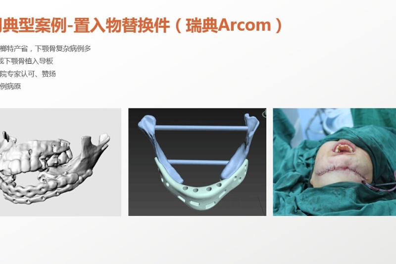 国内专注于3D数字化医疗应用研究的专业团队，看看他们有哪些精彩案例？