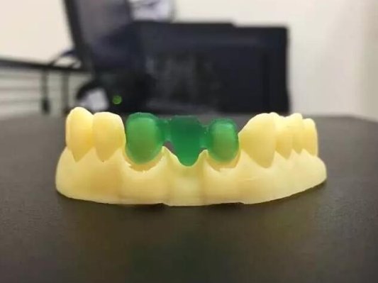 WELLS 3D 新一代数字化齿科打印专家