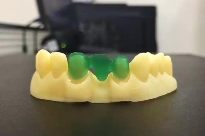 WELLS 3D 新一代数字化齿科打印专家