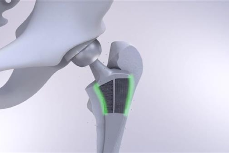 3D打印髋关节假体松动将不再是难题，“欧洲麻省理工”研发出会变形的生物超材料