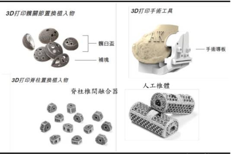 驾上3D打印战车，爱康医疗盈利驶入“加速道”