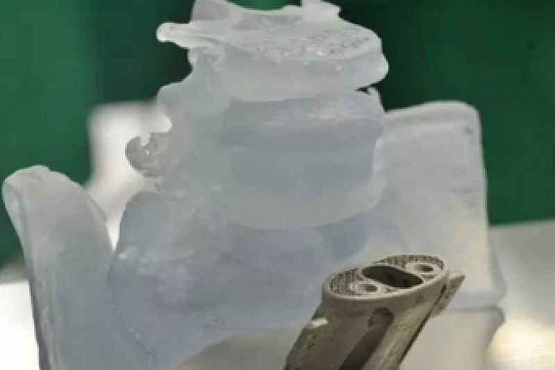 四川大学华西医院完成世界首例3D打印髌骨假体植入