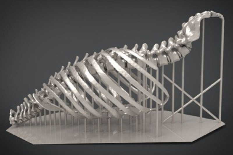 唐都医院开展3D打印PEEK胸壁重建手术