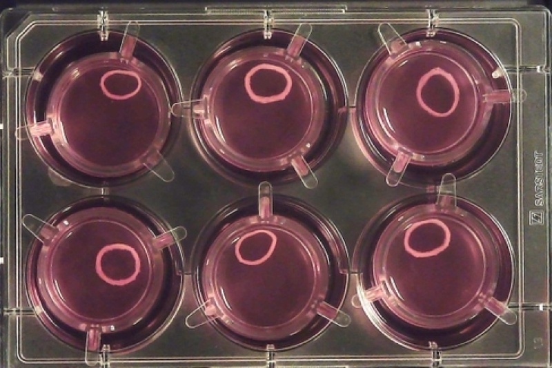 Aspect Biosystems因3D生物打印表现出色获资100万美元