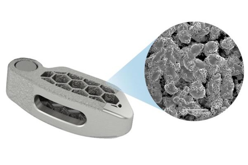 Medtronic推出用于脊柱植入物的钛3D打印平台“TiONIC”