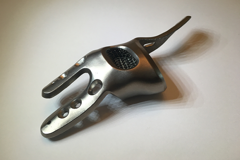 Additive Orthopaedics 3D打印医用植入物获得美食药监局510(k)许可