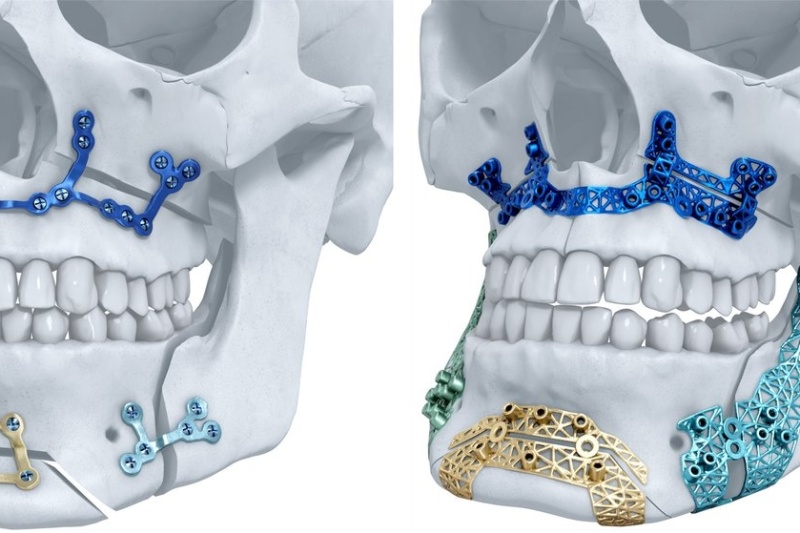 强生旗下子公司豪砸2亿在3D打印创新中心，到底想干啥？