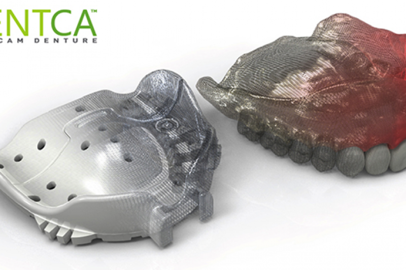 义齿制造百年革命：首个3D打印假牙基托材料获批上市