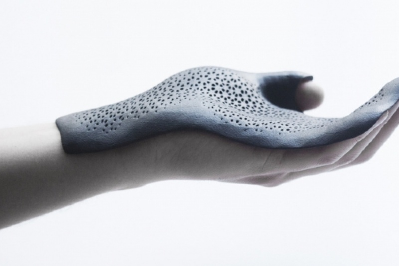 3D打印用于大规模肢体矫形器个性定制