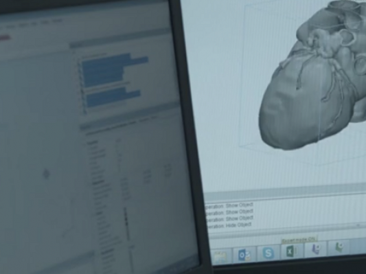 Materialise发布最新3D医疗建模软件