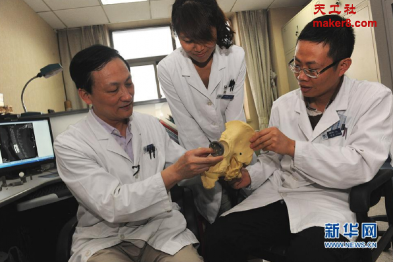 北医三院完成世界首例3D打印脊椎植入手术