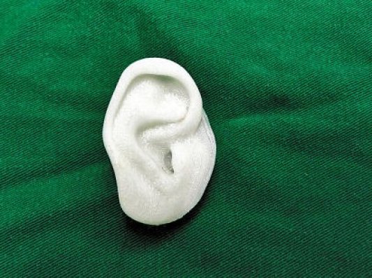 从技术层面解读“3D打印助9岁女童长出新耳朵”
