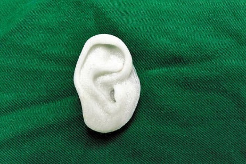 从技术层面解读“3D打印助9岁女童长出新耳朵”