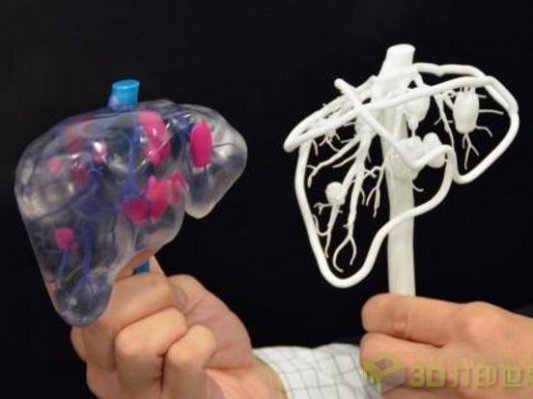 【友邦进展】日本将3D打印器官模型纳入医保支付范围