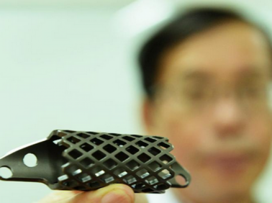 3D打印助杭州一大学生“再生”胸椎