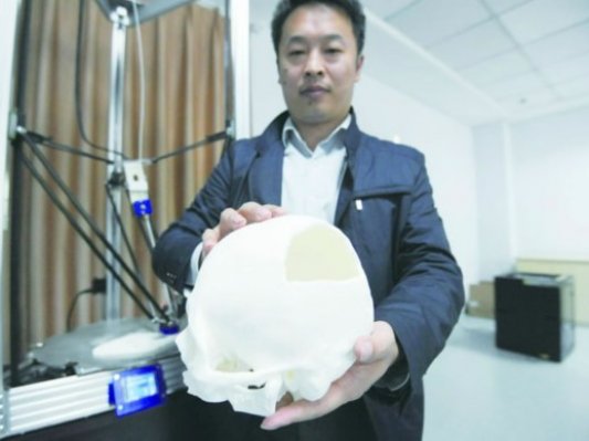 青岛首个医学3D打印中心成立并应用于临床