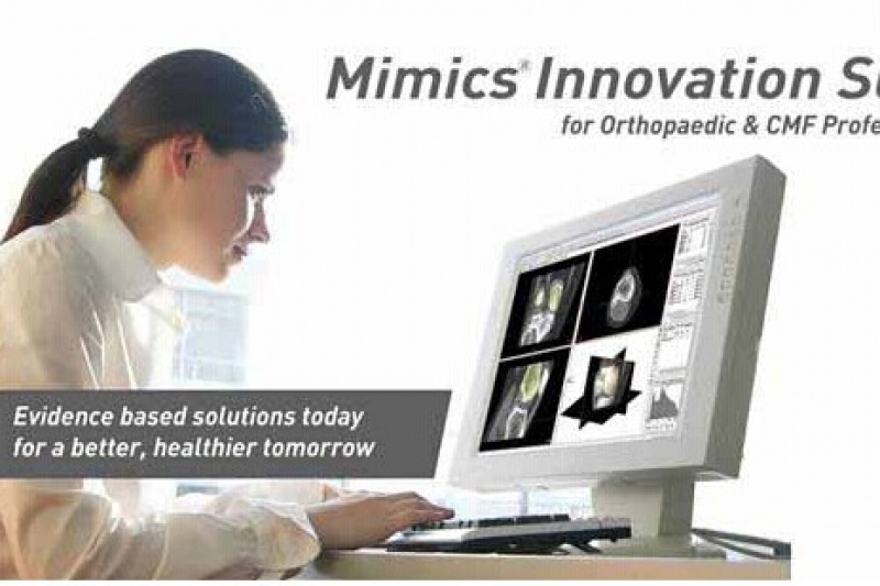 Materialise 发布新版Mimics软件
