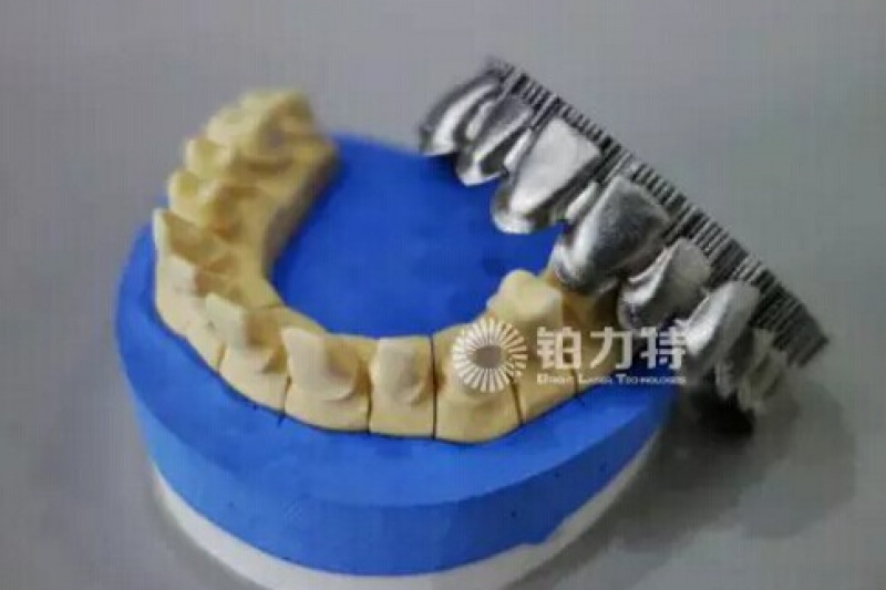 铂力特：金属3D打印如何变革义齿生产行业？