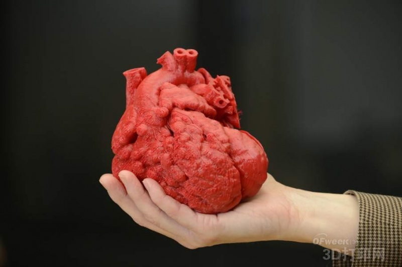 医学领域十大3D打印革新案例