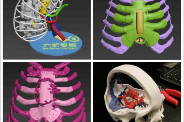 探秘数字化3D医疗应用