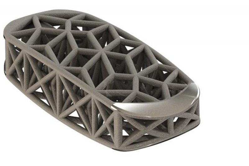 4WEB 的3D打印外侧椎间融合装置获FDA市场准入