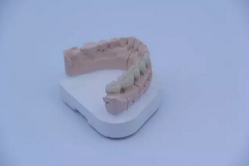 深耕齿科：永年激光推义齿成形设备YLM-120