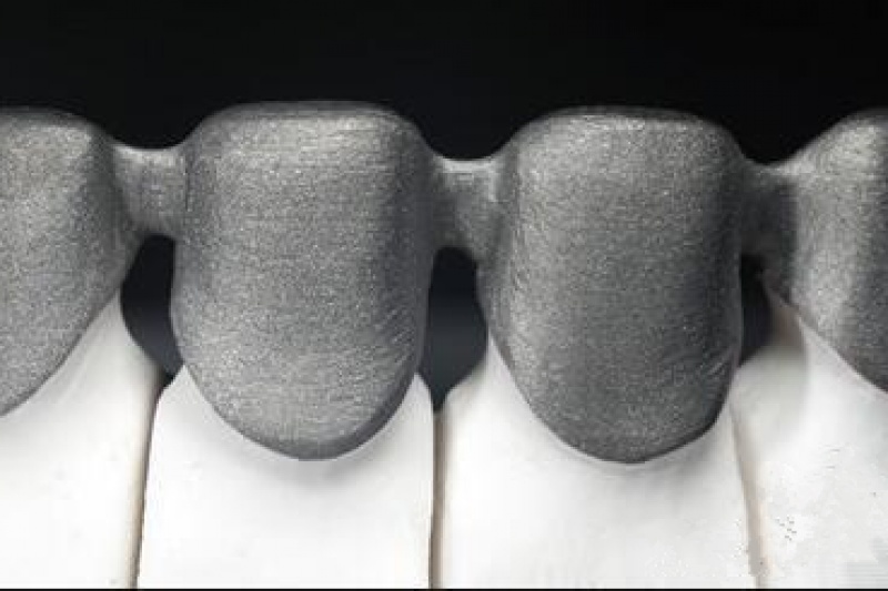 3D打印：口腔数字化变革的必然选择