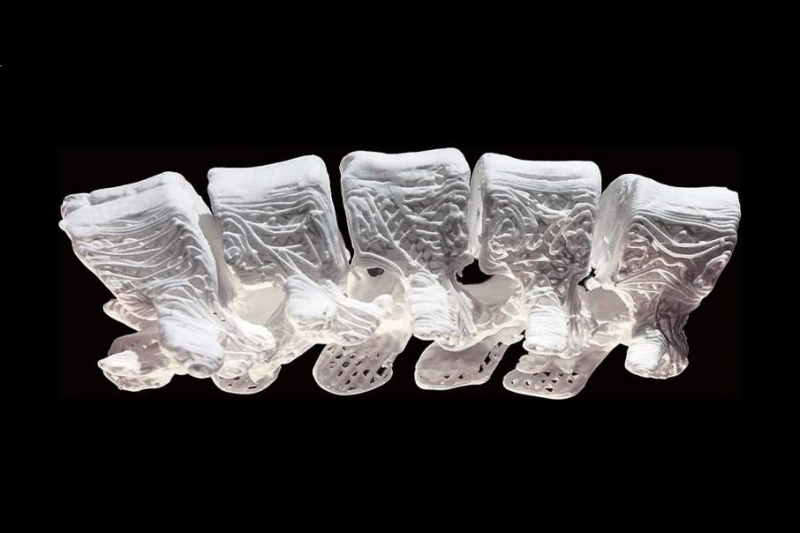 3D打印“超弹性骨头”   重建手术可快速融合再生