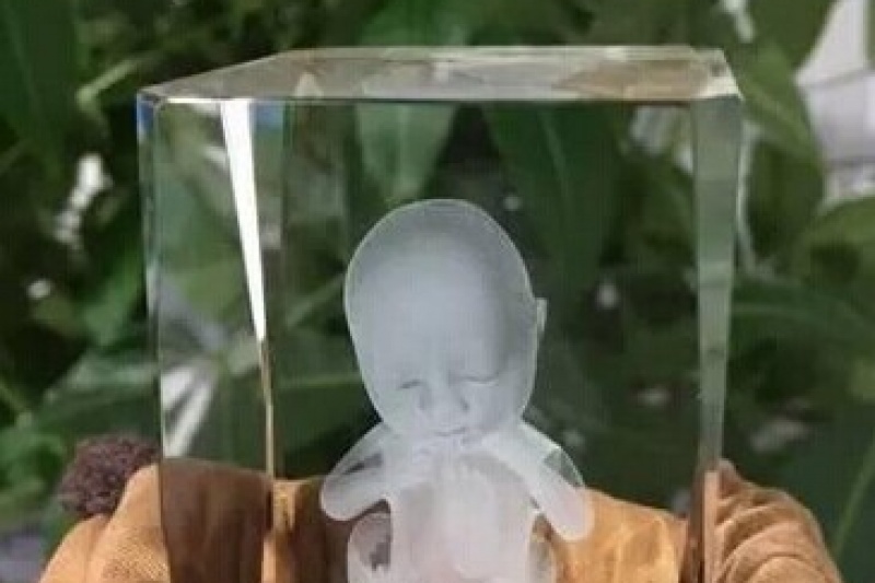 天使印记创始人杨登峰：胎儿3D打印是个好生意
