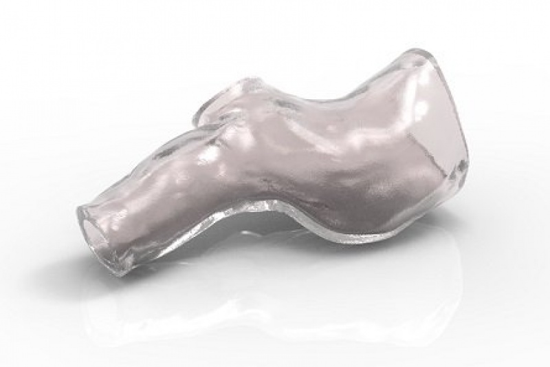 法国完成全球首例“3D打印模具辅助制作定制化支气管”植入手术