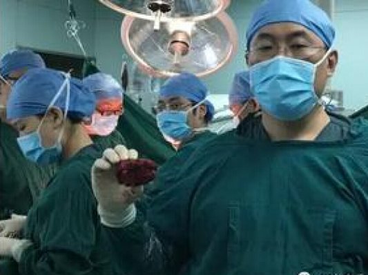 南方医科大学第三附属医院开展广东省首例3D打印人工椎体植入手术