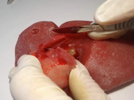3D打印硅胶器官真实到难以置信！会出血，医生用来练手是极好的